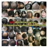 ราคา พร้อมส่ง-COD TOPPIK ผงไฟเบอร์สีดำ ปิดผมบาง หัวล้าน ผมบาง ขนาด 27.5 กรัม - สีดำ Toppik Hair Building Fiber (1730189711667989278)