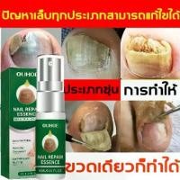 ราคา Ouhoe Nail Repair Treatment for Damaged Nails Improves Gray Nail Care 10ml (1732500847189263389)