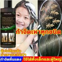 ราคา ใหม่ชุดยาฆ่าเหา LUCCAหัวหอม แก้คัน แชมพู สูตรกำจัดเหา ไข่เหา ผมสวย แชมพูเด็ก กำจัดเหา แชมพูกำจัดเหา สุดคุ้ม (1732084500701939852)