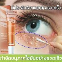 ราคา อายครีม เม็ดไขมันรอบดวงตา ครีมทาตาเม็ดไขมัน สิวข้าวสาร สิวหินอย่างมีประสิทธิภาพ กระชับผิว ผิวชุ่มชื้นเนียนน (1731632629662648984)
