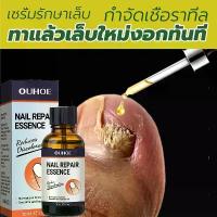 ราคา (เล็บสวย)เล็บเจลสวยๆ โภชนาการสำหรับเพ้นท์เล็บ น้ำยาดูแลเล็บ น้ำยาซ่อมแซม onychomycosis การซ่อมแซมการลอกเล็บที่สดใส มอยส์เจอไรเซอร์ (1732597228702238563)