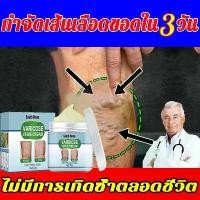 ราคา South Moon Varicose veins cream ครีมเส้นเลือดขอด ซ่อมแซมและบวมจืดยับยั้งอาการคันให้ความชุ่มชื้นรักษาสุขภาพด้วยครีมบำรุงผิวเหมาะสำหรับผู้ใหญ่ (1731579646711728198)