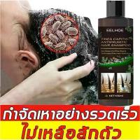 ราคา ใหม่ชุดยาฆ่าเหา LUCCAหัวหอม แก้คัน แชมพู สูตรกำจัดเหา ไข่เหา ผมสวย แชมพูเด็ก กำจัดเหา แชมพูกำจัดเหา สุดคุ้ม (1734749976554931673)