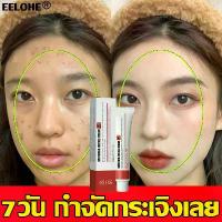 ราคา ผิวเป็นสิว ลบแผลเป็นจากสิวจุดด่างดำ ครีมกน้าขาวใส ครีมทาผิวกระ กระ ครีมไวท์เทนนิ่ง ครีมทาหน้าขาว โครีมทาฝ้ากระ ครีมทาฝ้ากระ ครีมแก้ฝ้าแท้ๆ ป้องกันริ้วรอย ดูกระจ่างผิวใส ทาฝ้าหนาลึก (173220475083007752