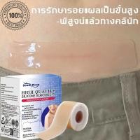 ราคา South Moonแผ่นแปะซิลิโคน แผ่นแปะคีลอยด์ ซิลิโคนยากำจัดแผลเป็น แผ่นแปะซิลิโคนเจล แผ่นแปะรอยแผลเป็นนูน ครีมลบรอยแผลเป็น (1731280296779286488)