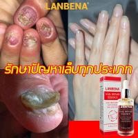ราคา บำรุงและซ่อมแซมเล็บ LANBENA เซรั่มบำรุงเล็บ เซรั่มซ่อมแซมเล็บ 12ml แถมตะไบตัดเล็บรักษาเล็บเสีย ต่อต้านการติตเชื้อรา บำรุงและซ่อมแซมเล็บ ซ่อมแซมเล็บแตก เล็บแตก ฯลฯ น้ำมันบำรุงเล็บดูแลเล็บรักษาเล็บขบรัก