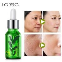 ราคา เซรั่มชาเขียว Rorec Green tea Serum 15 ml หน้าขาวเนียนใส ลดสิว กระชับรูขุมขน Beerly shop (877824983)