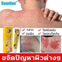 ราคา ครีมทาสะเก็ดเงินSumifun ยารักษาเชื้อรา เป็นต้นฉบับครีมทารักษาโรคสะเก็ดเงิน ยาทาโรคผิวหนัง ยาแก้คัน เชื้อราผิวหนัง ครีมสมุนไพรจีนเป็นต้นฉบับครีมทาบรรเทาโรค น้ำกัดเท้า กลาก เกลื้อน ผ (3541348345)
