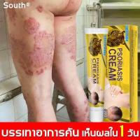 ราคา เห็นผลใน 1 วัน ไม่เด้งกลับ South ยาทาคันเชื้อรา โรคผิวหนัง สารสกัดจากพืชใช้ได้ทั้งตัว ครีมทาแก้คัน ยาทาเชื้อรา ครีมพญายอภูคาว โรคผิวหนัง ทากากเกลื้อน เหน็บชายา ครีมติดเชื้อรา คร (15535645795)