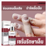 ราคา LANBENA เซรั่มบำรุงเล็บ เชื้อราเล็บมือ แก้เชื้อราที่เล็บ บำรุงเล็บ ลากับเล็บเสีย ไม่ทำร้ายเล็บดี ห่างกับปัญหาเล็บ ซ่อมแซมเล็บ (9906251020)