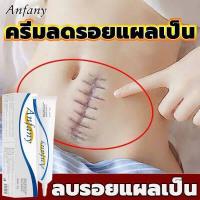 ราคา ครีมทาแผลเป็น ครีมลดรอยแผลเป็น ครีมลดรอยสิว เจลลบรอยแผลเป็น ครีมลดแผลเป็น ครีมลบรอยแผลเป็น ครีมลบแผลเป็น รอยแผลเป็น ครีมซ่อมแซม น้ำยาลบรอยแผลเป็น ยาลบลอยแผลเป็น ลดเลือนรอยแผลเป็น ค (9993219629)