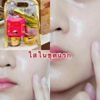 ราคา แพ็คกี้ไวท์ใสใส เจ้าเก่า แท้ 100 ชุดครีมแก้ฝ้า สบู่ เซรั่ม กลางวัน กลางคืน กันแดด เซรั่มหน้าใส สบู่ทับทิมคอลลาเจน Patky White (13310337271)