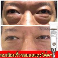 ราคา ครีมบำรุงรอบดวงตา อายครีม ลบถุงใต้ตา ตาบวม ลดความหมองคล้ำ ซ่อมแซมบริเวณรอบดวงตาอย่างล้ำลึก ครีมแก้ขอบตาดำ ครีมทารอบดวงตา (12821927136)