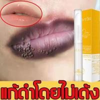 ราคา ให้ความชุ่มชื้น ปรับปรุงความหมองคล้ำ เลือนริ้วรอยริมฝีปากDETVFO ลิปบำรุงปากค้ำบำรุงริมฝีปากให้นุ่มชุ่มชื้น ให้อมชมพู ยาทาแก้ปากดำ ชุ่มชื่นริมฝีปาก ผลิตภัณฑ์บำรุงริมฝีปาก ครีมทาแก้ป (14818084460)