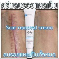 ราคา 7วัน เห็นผล ครีมลดรอยแผลเป็น ครีมลบรอยแผลเป็น เจลลบรอยแผลเป็น ครีมลบแผลเป็น น้ำยาลบรอยแผลเป็น ครีมลดแผลเป็น ยาลบลอยแผลเป็น ครีมทาลบรอยแผล ครีมทาแผลเป็น กำจัดรอยแตกลาย แผลไฟไหม้ น้ (17225939545)