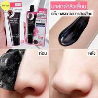 ราคา ถูก แท้ ส่งฟรี ซอง Clear Nose เคลียร์โนส เจลแต้มสิว ครีมกันแดด บีบีครีม โฟมล้างหน้า เซรั่ม น้ำตบ เจล ลดสิว รักษาสิว (18691861905)