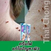 ราคา ครีมไฝ ผลิตภัณฑ์ไฝ หูดตาปลาและติ่งเนื้อไฝ ขี้แมลงวัน แก้ไขปัญหาผิว (18986559864)