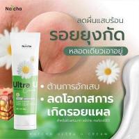ราคา รอยดำยุงกัดหายได้ Ultra U อัลตร้ายู ครีมทาสะเก็ดเงิน กลาก เกลื้อน น้ำกัดเท้า เชื้อราผิวหนัง (15631593662)