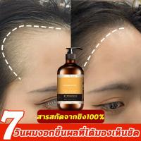 ราคา ซื้อ 1 แถม 1 แชมพูเร่งผมยาว แชมพู แชมพูขิง แชมพูสระผม ป้องกันผมร่วง แชมพูกรดอ่อน ขิงช่วยป้องกันผมร่วง ยาสระผมแก้ร่วง ผู้หญิงผมร่วง ผู้ชายผมร่วง บำรุงเส้นผมและรากผม ผมบาง หัวล้าน แชมพูขิงเพียว แชมพู บ 