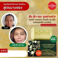 ราคา สบู่สมุนไพร สูตรนางแซง ลดปัญหา ฝ้า กระ จุดด่างดำ (20795804673)