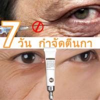 ราคา ครีมลดถุงใต้ตา ครีมทาใต้ตาดำ ครีมทาถุงใต้ตา ครีมลบถุงใต้ตา อายครีม กระชับ ยกกระชับ รอยตีนกา ลดรอยคล้ำใต้ตาลดถุงใต้ตาบวม บรรเทาปัญหาต่างๆรอบดวงตา eye cream (20423671424)