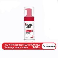 ราคา ACNE AID OIL CONTROL FOAM WASH 100ML แอคเน่ เอด ออยคอนโทรล โฟม 100 มล โฟมล้างหน้า (16908368106)