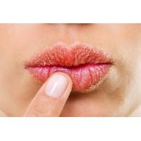 ราคา Himalaya Heal Lip 10 g ลิปบาล์มบำรุง รักษาริมฝีปากแห้ง (11340473442)