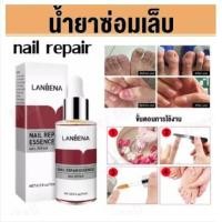 ราคา LANBENA เซรั่มบำรุงเล็บ เชื้อราเล็บมือ แก้เชื้อราที่เล็บ บำรุงเล็บ ลากับเล็บเสีย ไม่ทำร้ายเล็บดี ห่างกับปัญหาเล็บ ซ่อมแซมเล็บ (21083096462)