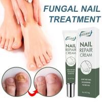 ราคา Eeelhoe Nail Repair Cream Repair Cream ไม่เจ็บปวด Anti Onychomycosis Paronychia Feet Care Treatment Anti Fungal Toe 20G (16351407570)