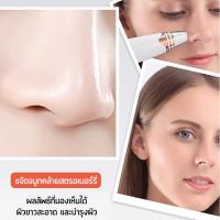 ราคา เครื่องดูดสิวไฟฟ้า พร้อมส่ง ปรับระดับได้ ดูดสิวเสี้ยน สิวข้างจมูก สิวอุดตัน แถมฟรีหัวดูด 3 ชิ้น (8080551517)