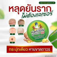 ราคา ผลิตภัณฑ์ไฝ แต้มไฝ ขี้แมลงวัน หูดตาปลาและติ่งเนื้อ ตาปลา ครีมตาปลา ทาไฝ จี้ไฝ แต้มขี้แมลงวัน จีจี้ (21349182028)