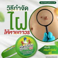 ราคา ผลิตภัณฑ์ไฝ แต้มไฝ ขี้แมลงวัน หูดตาปลาและติ่งเนื้อ ติ่งเนื้อ ครีมไฝ ทาไฝ จี้ไฝ แต้มขี้แมลงวัน จีจี้ (21348603748)