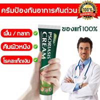 ราคา ครีมลดอาการคัน ปัญหาคันเรื้อรัง ดีขึ้นใน 1 กระปุก ยาทาแก้คัน แก้คัน ตุ่มเหงื่อ ผื่นผิวหนัง ครีมทาภายนอก 20g (21445451996)