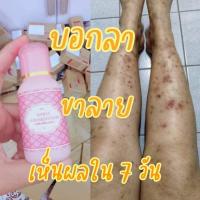 ราคา เซรั่มลบรอยแตกลาย ท้องลาย ขาลาย ก้นลาย ขวดใหญ่ขนาด 30กรัม (20523053391)