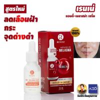 ราคา RENNE ของแท้ เรนเน่ แอนตี้ เมลาสม่า เซรั่ม ลดเลือนฝ้า กระ จุดด่างดำ สิว (21517477294)