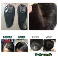 ราคา แฮร์พีชผมแท้ ฐานsilk แผ่นปิดผมบางแสกกว้าง ปิดผมหงอก ราคาถูก เสริมได้ทั้งหญิง ชาย ผมแท้100 ย้อมสีได้ Topper Silk Base 5 8cm (15506707568)