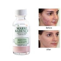 ราคา Mario Badescu โลชั่นแก้ผิวแห้ง เอสเซนส์ต่อต้านสิว ผลิตภัณฑ์ช่วยลดปัญหาสิว รอยหลังจากการเกิดสิว ลดปัญหาการอุดตัน 29ml (21624506010)
