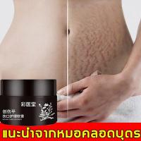 ราคา ครีมลดรอยแตกลาย ครีมรอยแตกลาย ครีมทาขาแตกลาย ครีมทาหน้าท้อง ครีมลดผิวแตก ครีมทาท้องลาย ครีมกันแตกลาย ครีมทาหลังคลอด 35g (21243117110)