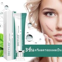 ราคา 30g FENNY ครีมทาแผลเป็น ยาทาแผลเป็น ครีมลบรอยแผลเป็นจากสิว รอยแผลเปน ลอยแผลเป็น ครีมรอยแผลเป็น ฮีรูดอย ทุกประเภท (21717154616)