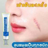 ราคา ลบรอยแผลเป็น ครีมทาแผลเป็น ครีมลดแผลเป็น scar removal cream ยาทาแผลคีลอยด์ ครีมทาแผลผ่าคลอด ลดแผลไฟไหม้ แผลน้ำร้อนลวก แผลผ่าตัดเป (21452376308)