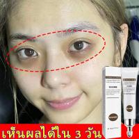 ราคา ครีมทาถุงไต้ตา กระชับ ยกกระชับ ลดรอยคล้ำใต้ตา ครีมลบถุงใต้ตา ครีมทาถุงใต้ตา ครีมลดถุงใต้ตา อายครีมลดใต้ตา เซรั่มถุงใต้ตา ครีมทาใต้ตา อายครีมบำรุงตา ครีมบำรุงถุงใต้ตา ลดถุงใต้ตาบวม ลดถุงน้ำใต้ตา eye ba