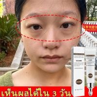 ราคา เซรั่มถุงใต้ตา ครีมทาใต้ตา อายครีมบำรุงตา ครีมบำรุงถุงใต้ตา ลดถุงใต้ตาบวม ลดถุงน้ำใต้ตา ครีมทาถุงไต้ตา กระชับ ยกกระชับ ลดรอยคล้ำใต้ตา ครีมลบถุงใต้ตา ครีมทาถุงใต้ตา ครีมลดถุงใต้ตา อายครีมลดใต้ตา eye ba