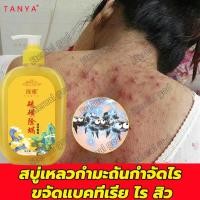 ราคา TANYA สบู่เหลวกำมะถันกำจัดไร ครีมอาบน้ำหอมๆ408ml ลบสิวควบคุมน้ำมัน ปรับสี ขจัดกลิ่นเหงื่อ ชะล้างรูขุมขน พร้อมฟื้นบำรุงผิว สบู่สมุนไพรธรรมชาติ ครีมอาบน้ำขาว เจลอาบน้ำกลิ่นหอม สบู่ สบู่เหลว ครีมอาบน้ำ ค