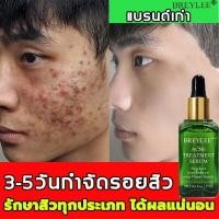 ราคา BREYLEEเซรั่มลดสิว17mlครีมลดสิวสิวอุดตันสิวผดไม่มีหัว รอยดำจากสิวรอยแดง ครีมแต้มสิว เจลรักษาสิว เจลแต้มสิว ครีมกำจัดสิว เจวแต้มสิว ครีมสลายสิว ครีมทาสิวต่างๆ ครีมทารอยสิว เซรั่มทารอยสิว เจลทาสิว เซรั่