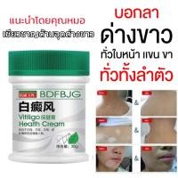 ราคา โรคด่างขาว ด่างขาว ครีมทาด่างขาว Vitiligo 30g กำจัดด่างขาวอย่างรวดเร็ว สีผิวไม่เสมอ สารสกัดจากสมุนไพร ส่วนผสมอ่อนโยน (21644153222)