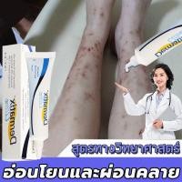 ราคา ดูดซับง่ายDermatix ครีมทาแผลเป็น ลดรอยเเผลเป็น ประสิทธิภาพ ครีมลบรอยแผลดำ ครีมกำจัดแผลเป็น ครีมทาแผลเป็นนูน ยาทาแผลเป็นนูน ยาลบลอยแผลเป็น ครีมลดแผลเป็น ยาทาเเผลเป็น ครีมลบแผลเป็น ครีมทารอยแผลดำ ครีมลบ