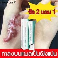 ราคา Breylee ของแท้ ยาทาแผลเป็น ครีมทาแผลเป็น ครีมทาแผลเป็น ครีมลบรอยแผลเป็น ซ่อมแซม แผลไฟไหม้ แผลเป็นผ่าตัด รอยแผลเป็นเป็นต้น ช่วยให้แผลเป็นหายสนิท scar gel (21727118998)