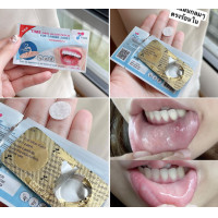 ราคา รู้งี้ซื้อนานแล้ว เป็นร้อนในเก่งมาก ตัวยาคือ เป็นแผ่นกลมๆแปะแล้วมันละลายหายไปเลย TIME ORAL ULCER PATCH แผ่นแปะแผลร้อนใน 6 ชิ้น Piracha shop (15178469061)