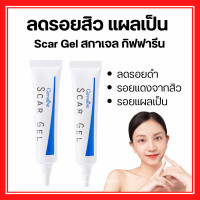 ราคา สการ์เจล กิฟฟารีน scargel สกาเจล เจลแต้มสิว giffarine รอยสิว ครีมแต้มสิวอักเสบ รอยแผล รอยแดง รอยดำ จุดด่างดำ และ สิว (20915329845)