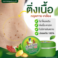 ราคา ผลิตภัณฑ์ไฝ ขี้แมลงวัน หูดตาปลาและติ่งเนื้อไฝ ขี้แมลงวัน แต้ม ทาติ่งเนื้อ ครีมแต้มไฝนางงาม (21349380906)